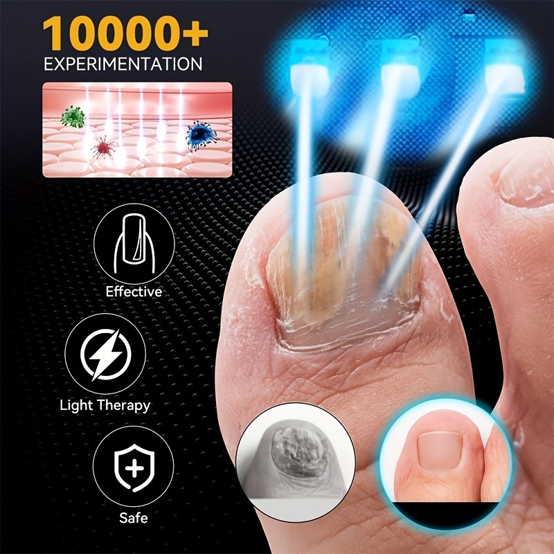 KTS Nail Fungus Laser Cleanning Device Onychomycosis Fungal Toenail Treatment