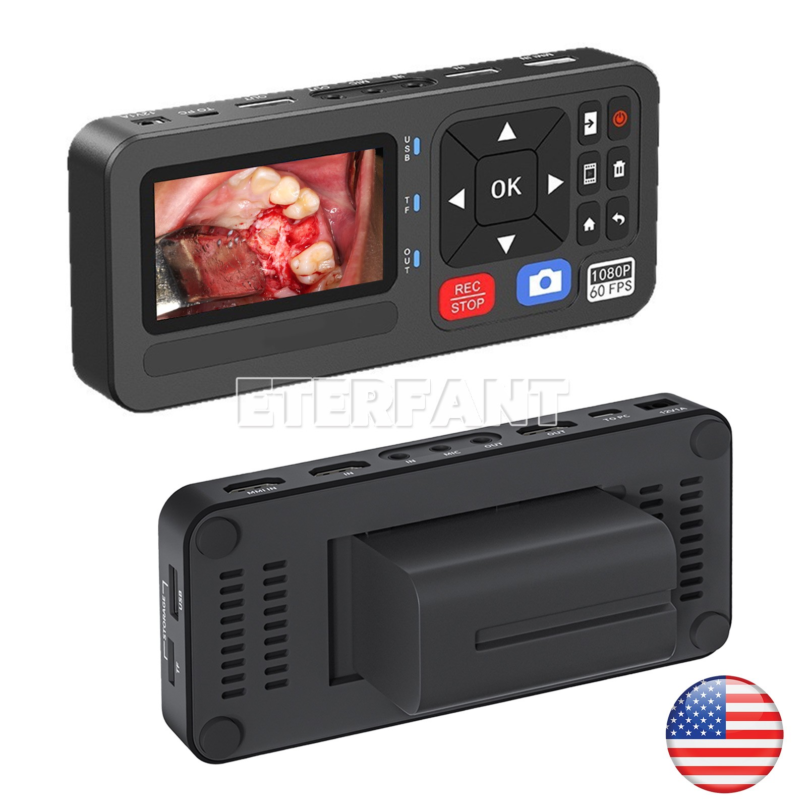 Portable Medical Surgical Recorder for Laparoscopy and Endoscopy Capture