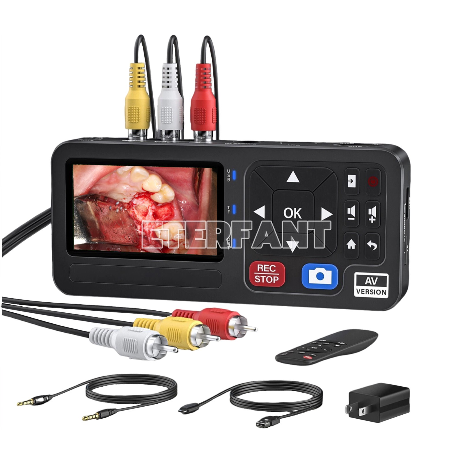 Portable Medical Surgical Recorder 1080P for Laparoscopy and Endoscopy Capture
