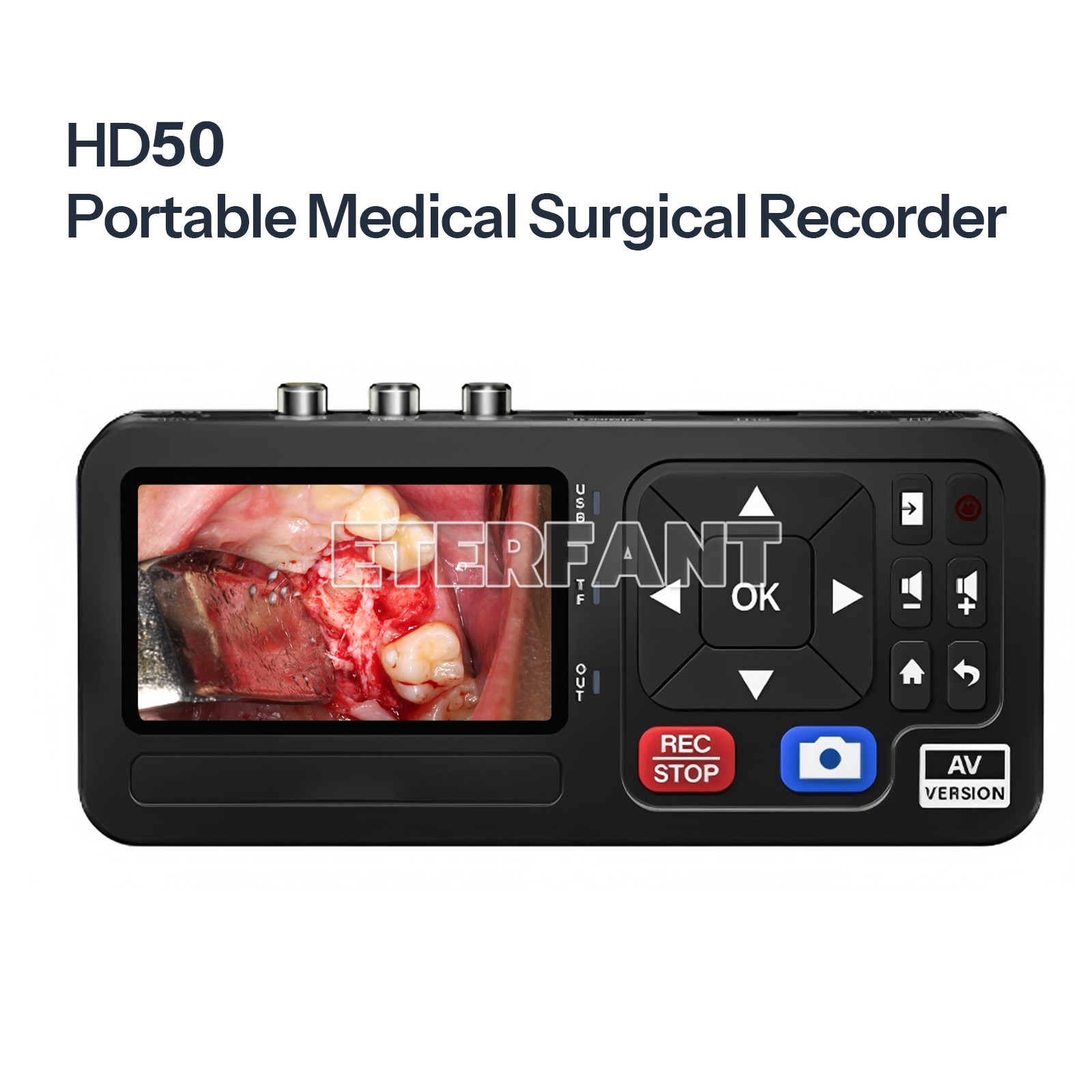 Portable Medical Surgical Recorder 1080P for Laparoscopy and Endoscopy Capture