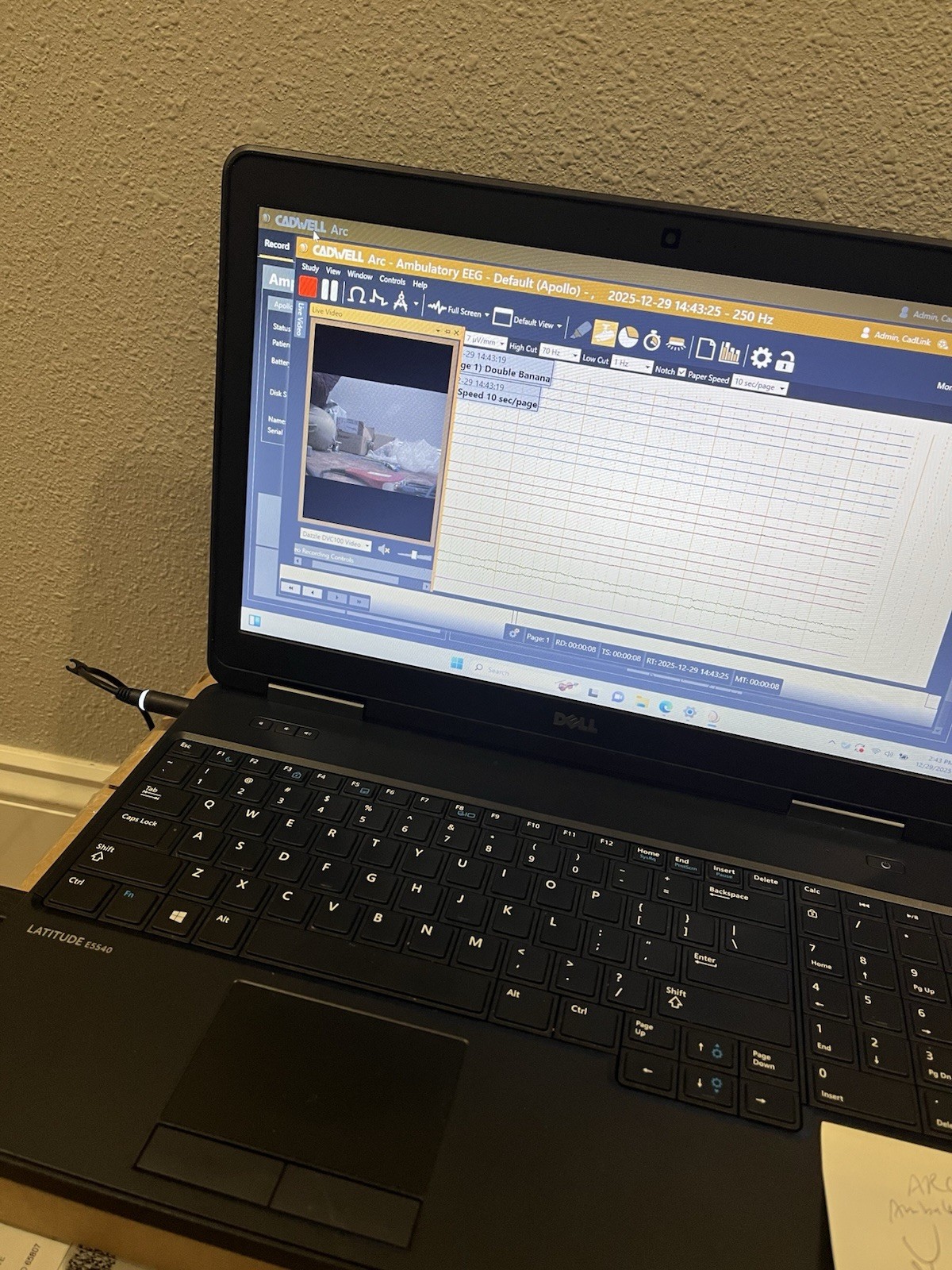 Cadwell Arc (Essentia or Apollo) EEG Laptop, See Description Below