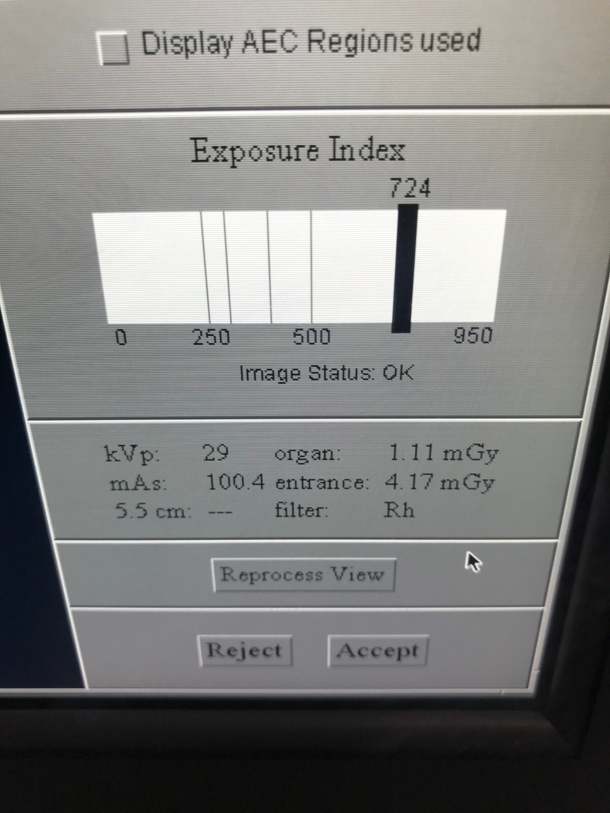 GAMMEX RMI 156 phantom 18-220 ACR QA mammography xray test tool Unfors Raysafe z