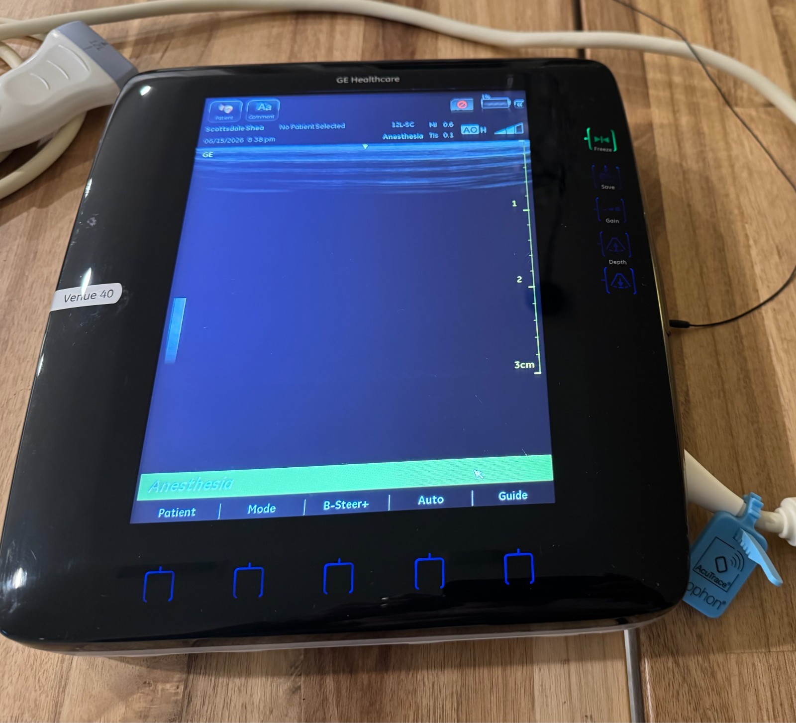GE Venue 40 Portable Ultrasound Machine 5418778 With 12L-SC Transducer