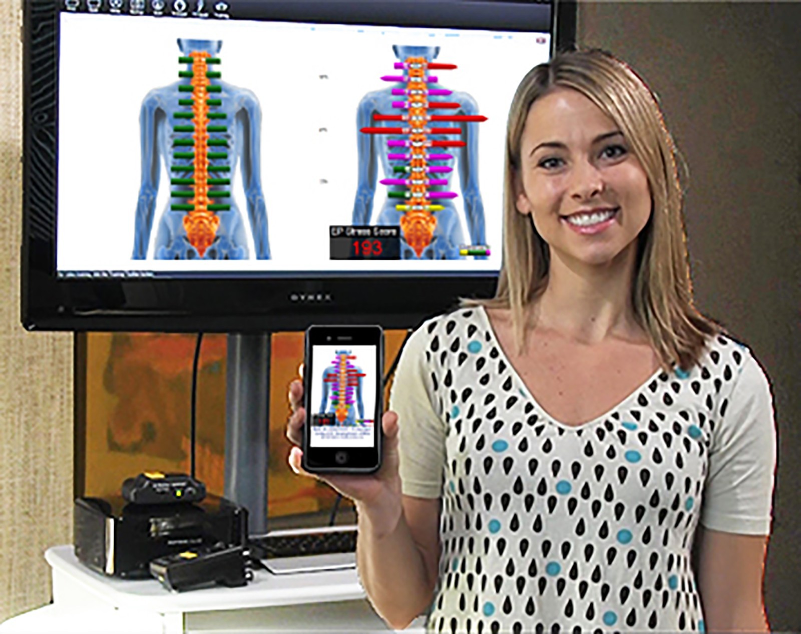 MyoVision ScanVision Single Scanner 4G – Recertified New- «powerful patient ed»