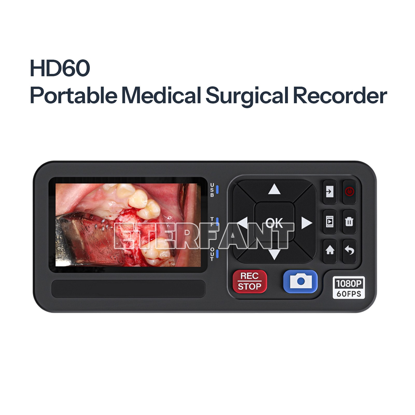 3Inch Screen Medical Surgical Recorder F Laparoscopy and Endoscopy Capture 1080P