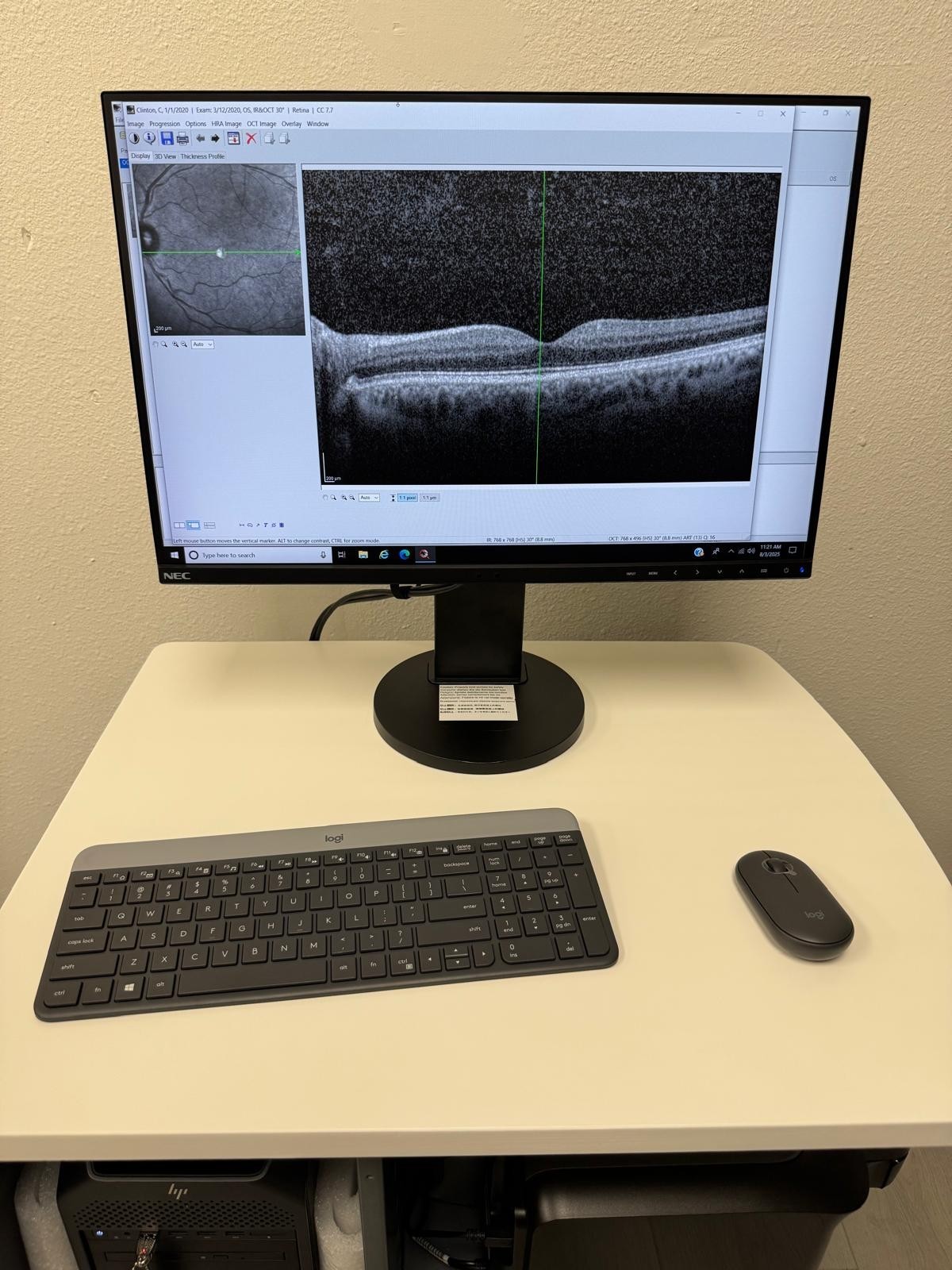 HEIDELBERG Spectralis HRA 3 MODE-FULLY REVISED