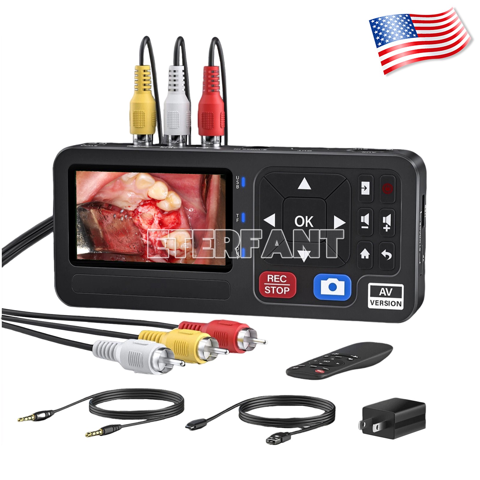 Portable Medical Surgical Recorder for Laparoscopy and Endoscopy Capture HD50