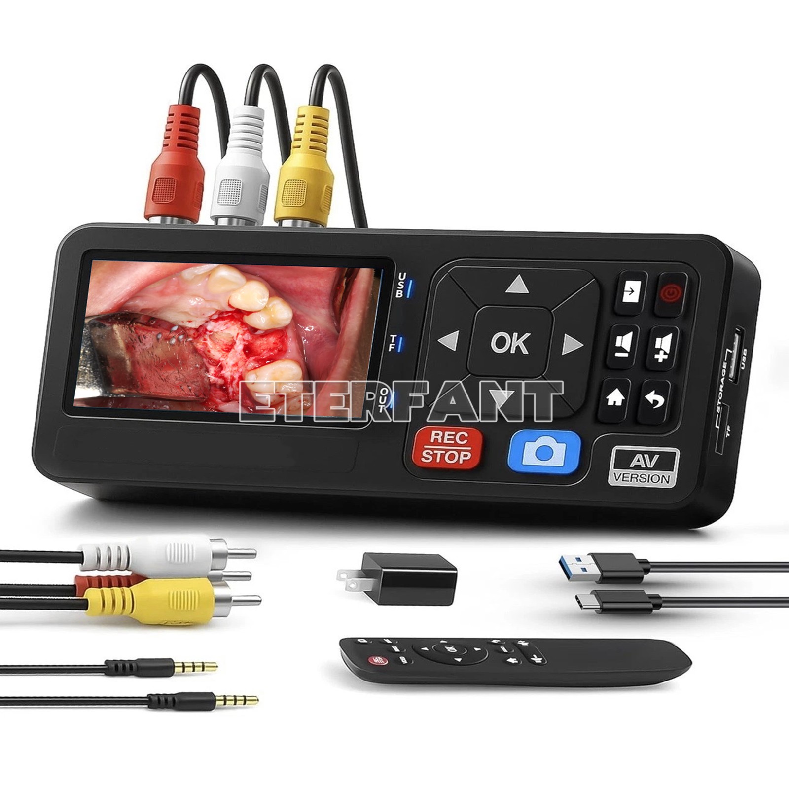 Portable Medical Surgical Recorder 1080P for Laparoscopy and Endoscopy Capture