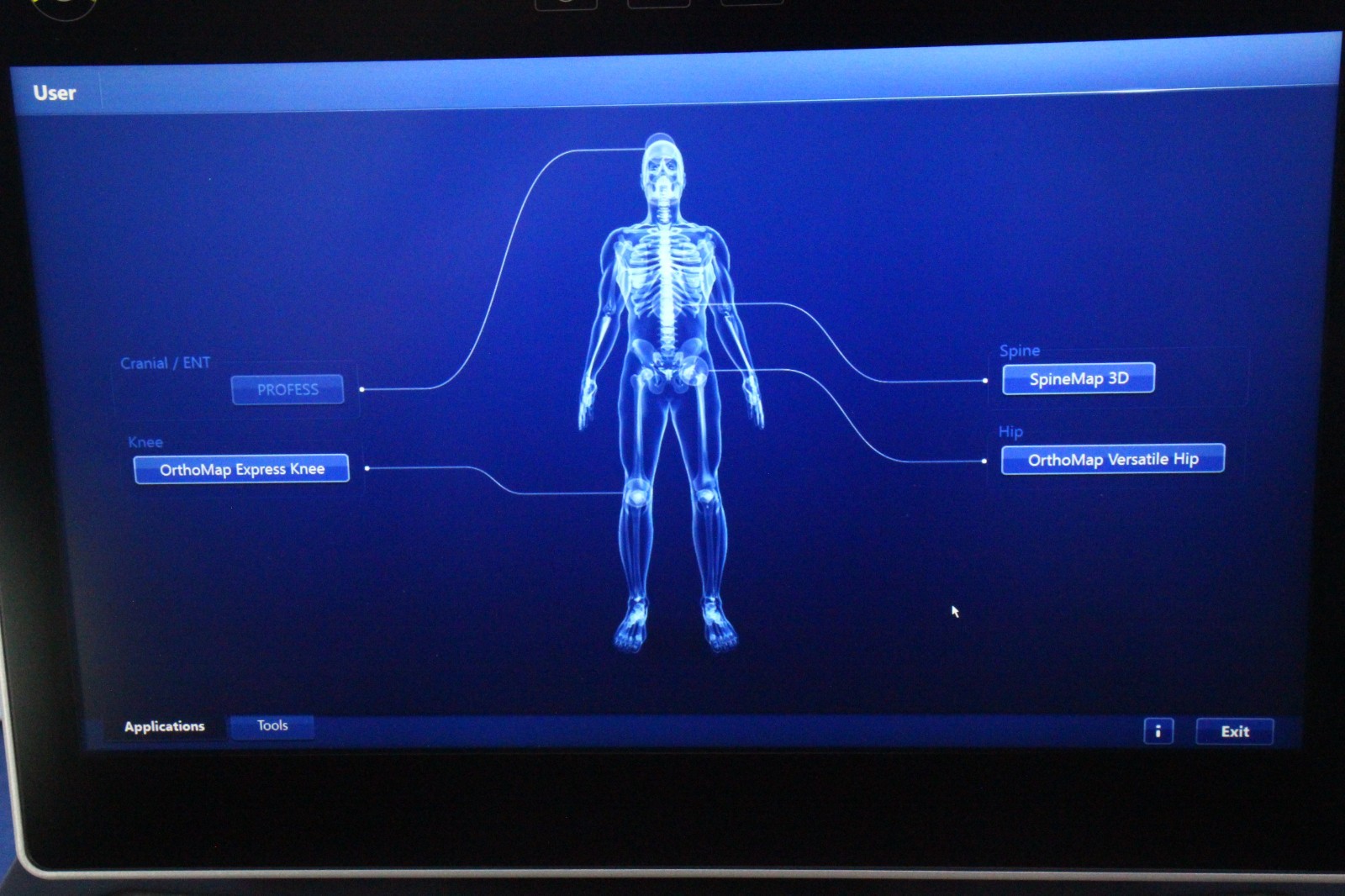 Stryker NAV3 Surgical Navigation System HD Surgical Navigation w/ Hip, Spine Map