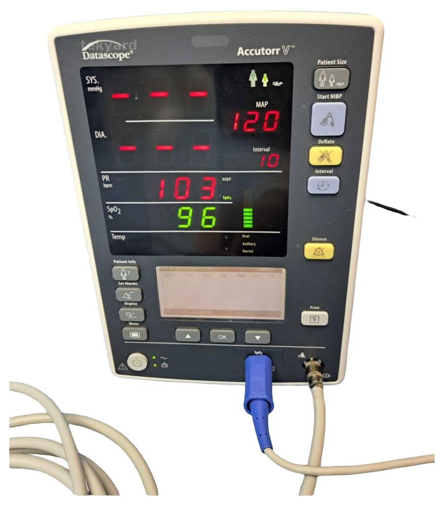 MINDRAY DATASCOPE ACCUTORR V VITAL SIGNS MONITOR @