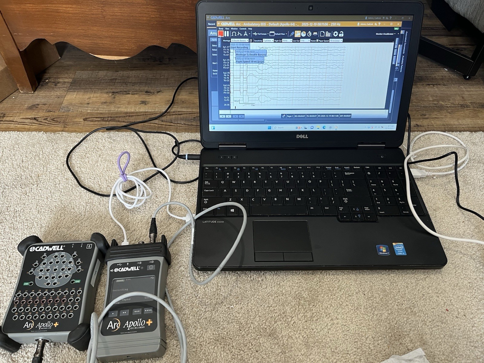Cadwell Arc (Essentia or Apollo) EEG Laptop, See Description Below
